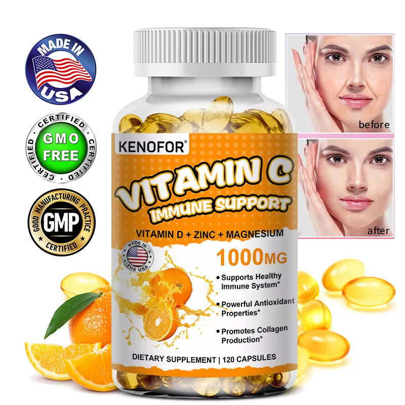 Vitamin C Supplement – Immune Support, Collagen & Skin Health