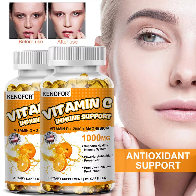 Vitamin C Supplement – Immune Support, Collagen & Skin Health