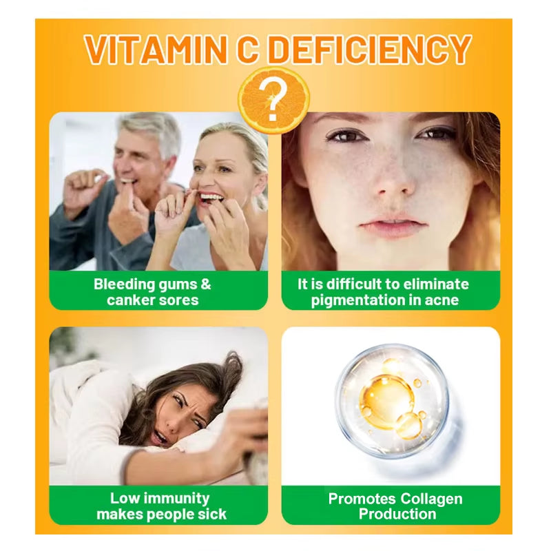 Vitamin C Supplement – Immune Support, Collagen & Skin Health